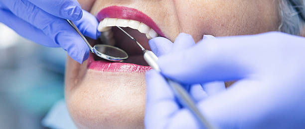 Best Emergency Treatment for Toothache in Dimondale, MI